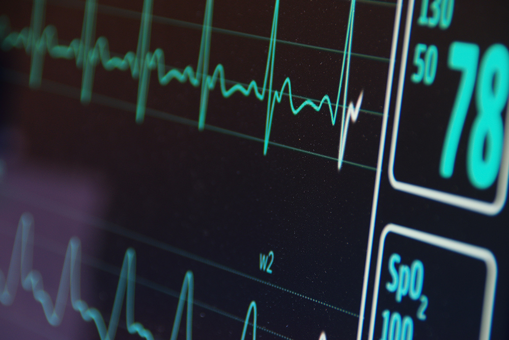 Ambulatorio-ipertensione-Hera-Vicenza-Elettrocardiogramma